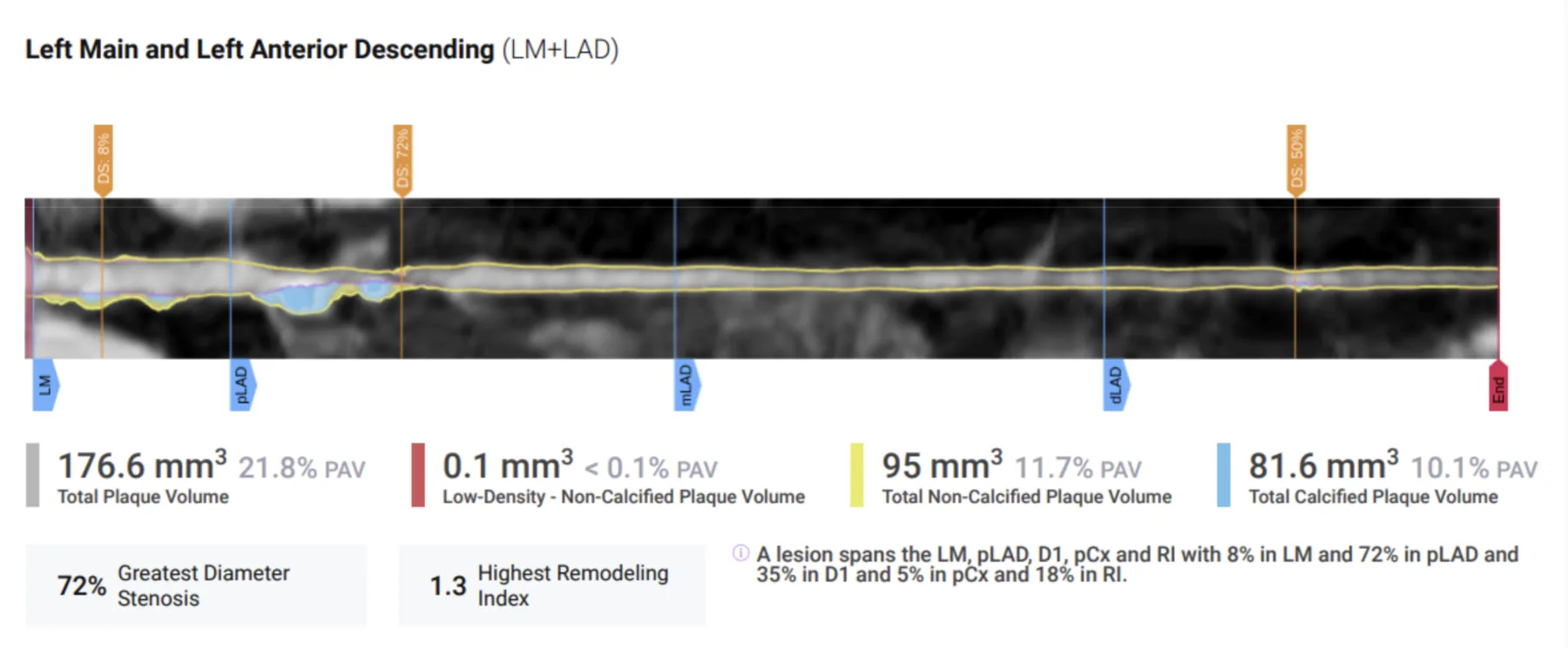 Follow-up scan — Kerry Ragbir