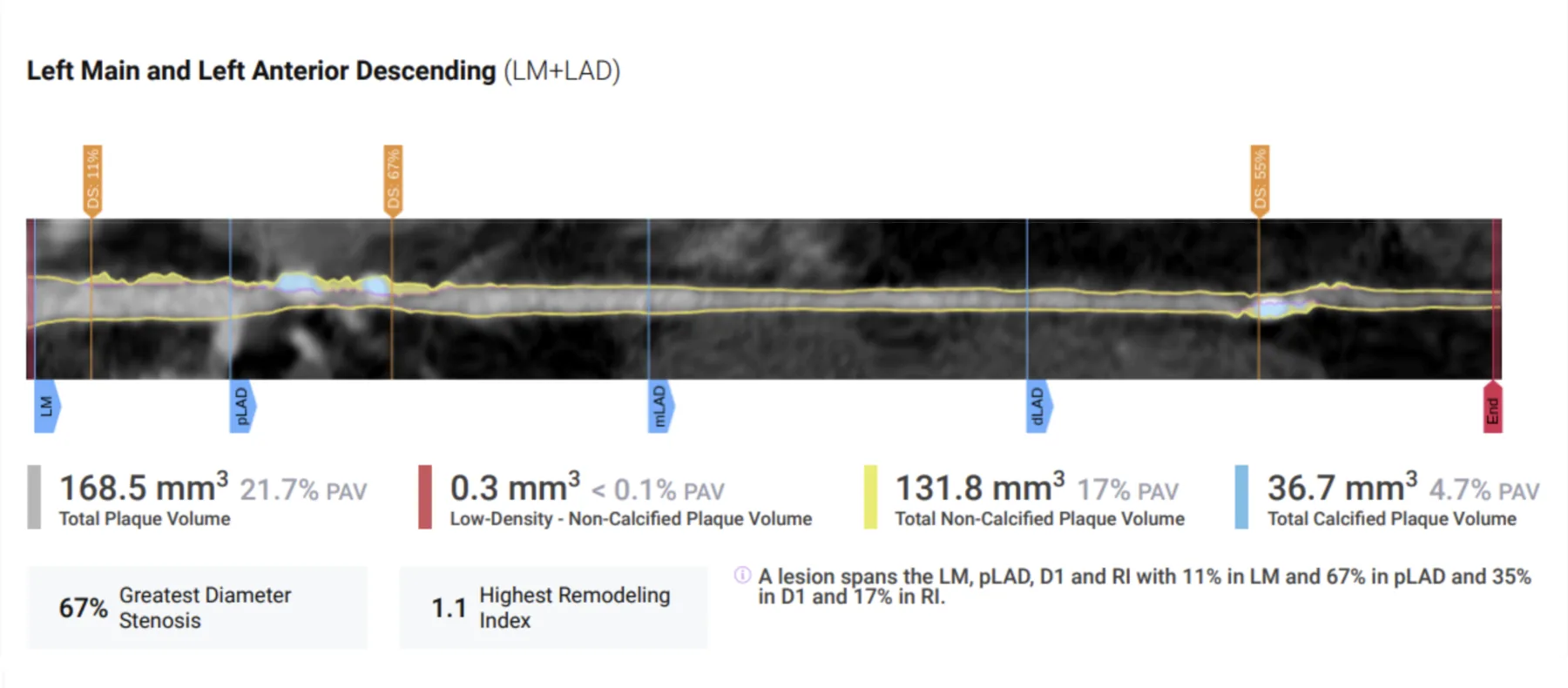 Baseline scan — Kerry Ragbir