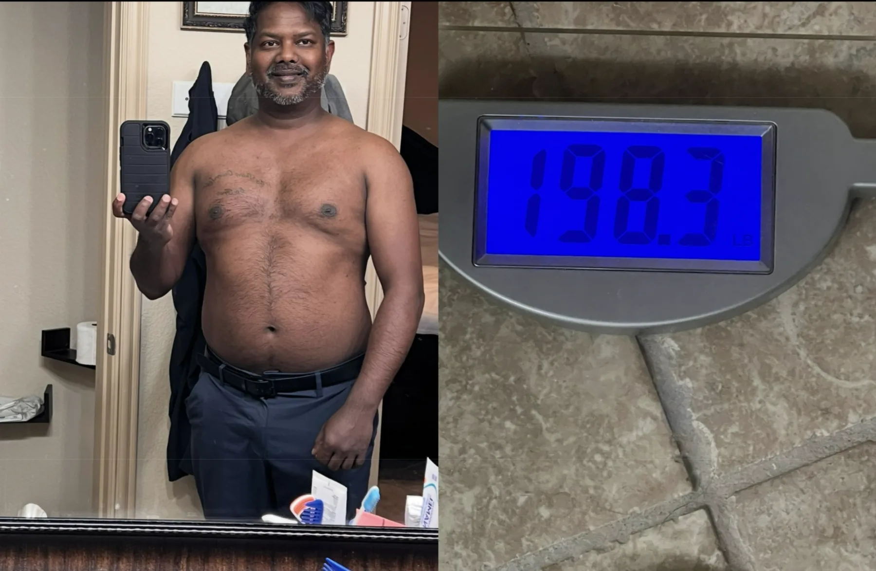 Progress photo — baseline — Kerry Ragbir