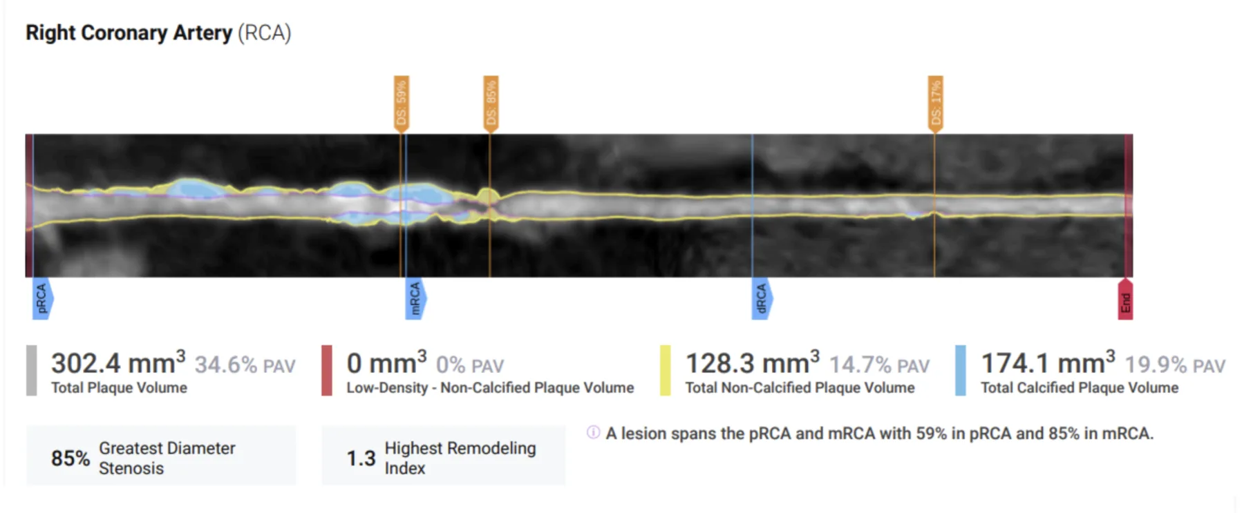 Baseline scan — Mark Cozart