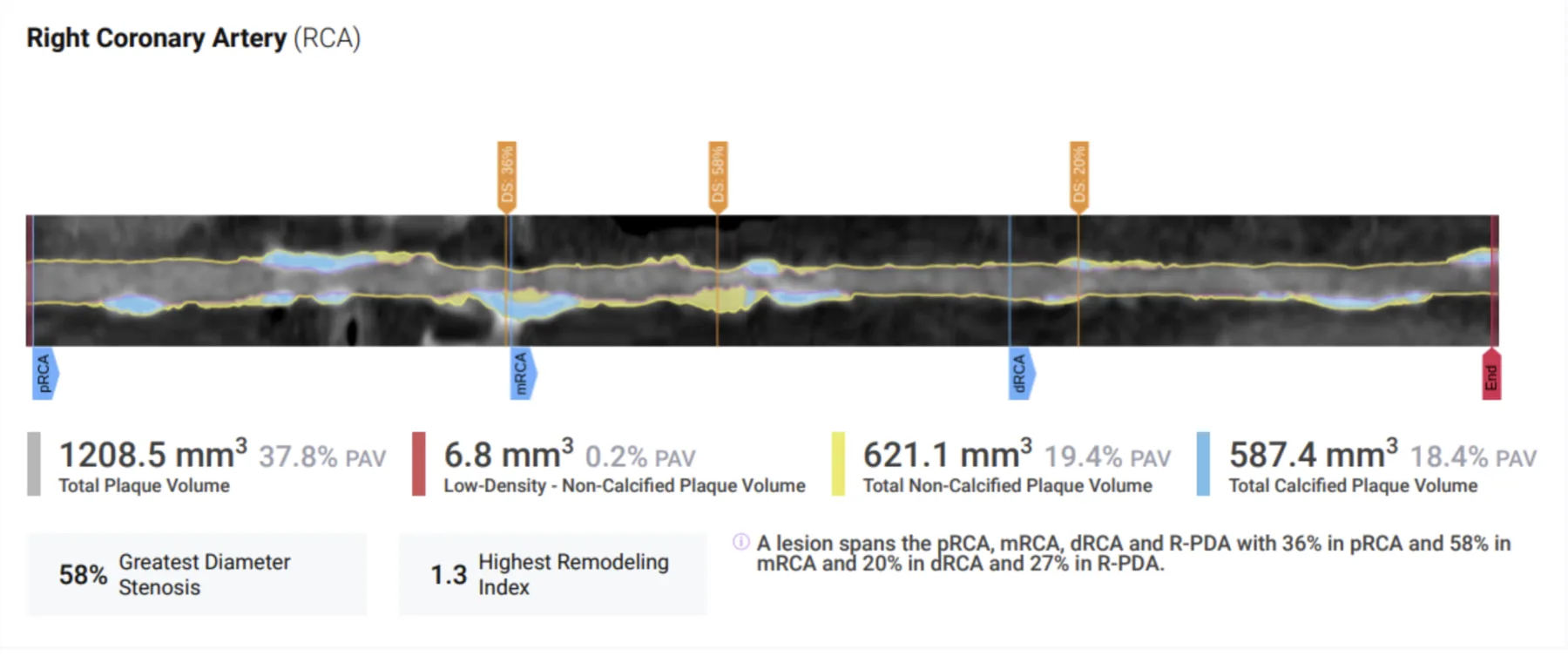 Baseline scan — Tim Ritter
